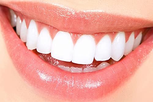 Oral anesthetic Treatment for Canker sores