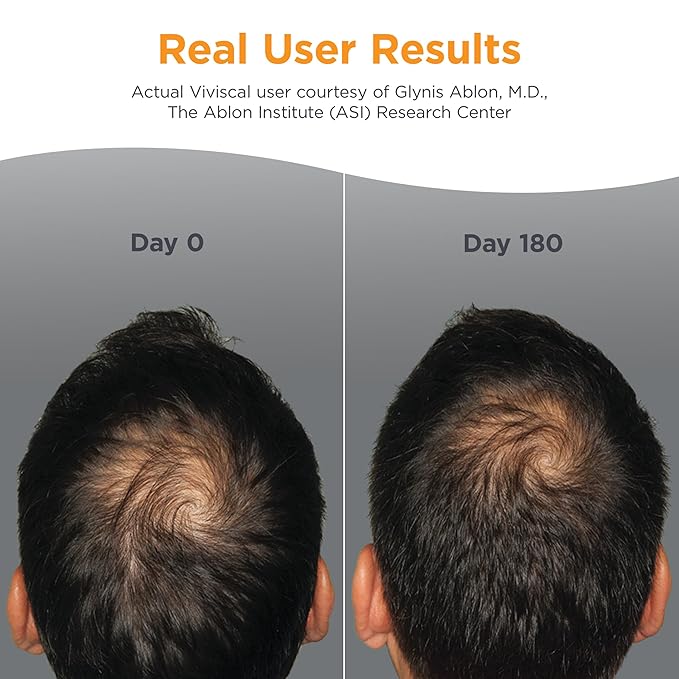 Viviscal Men's Hair Growth Supplements for Thicker, Fuller Hair Clinically Proven with Proprietary Collagen Complex, 60 Tablets - 1 Month Supply