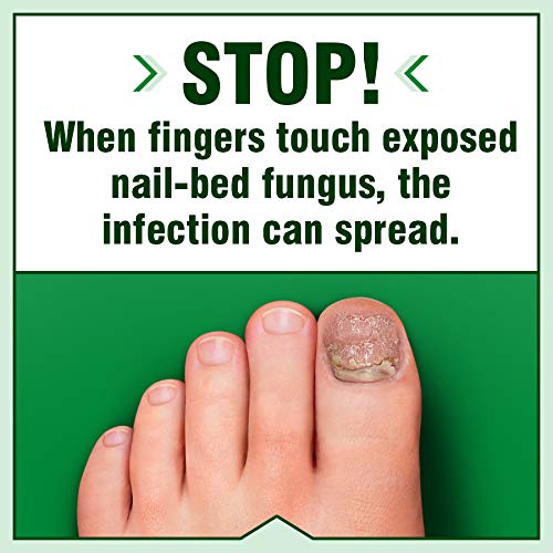 FUNGICURE Intensive Spray, Antifungal Treatment, Kills 6 Types 2 Fl 1)