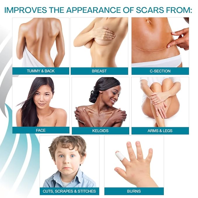 NewGel+ Advanced Silicone Scar Treatment Sheeting 1" x 6" Sheet (4 Count)