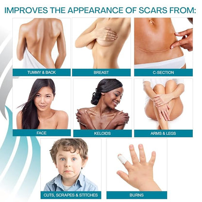 NewGel+ Advanced Silicone Scar Treatment Sheeting 1" x 6" Sheet (4 Count)