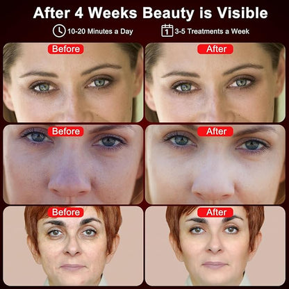 Red Light Therapy for Face, 4 660nm & 850nm Wavelength