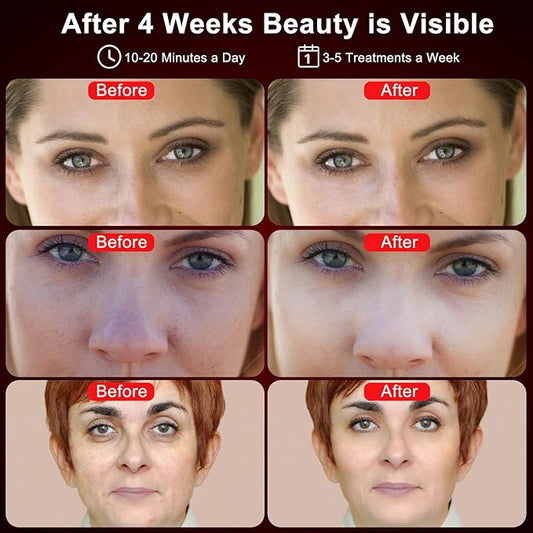 Red Light Therapy for Face, 4 660nm & 850nm Wavelength