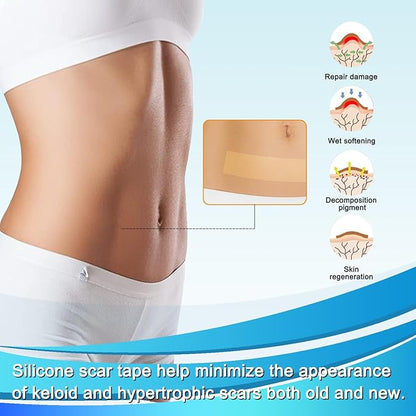 Medical Grade Silicone Scar Tape (1.6" x 157" - 4M) Professional