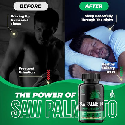 Saw Palmetto for Men - Prostate Health Supplements for Men Urinary Health - Natural DHT Blocker, 500mg Extra Strength Hair Regrowth Treatments - 100 Capsules 3 Months Supply