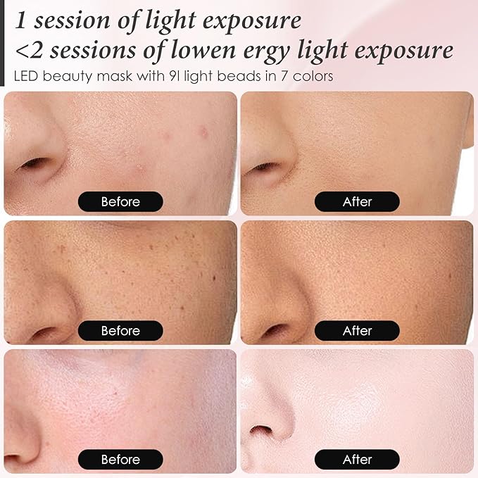 Red Light Therapy Mask for Face, 7 Colors