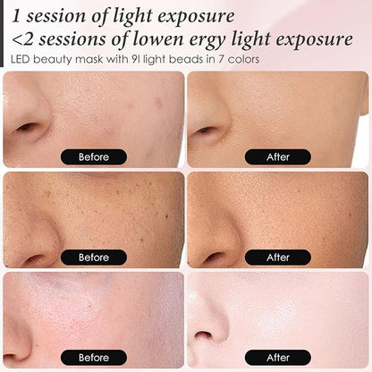 Red Light Therapy Mask for Face, 7 Colors