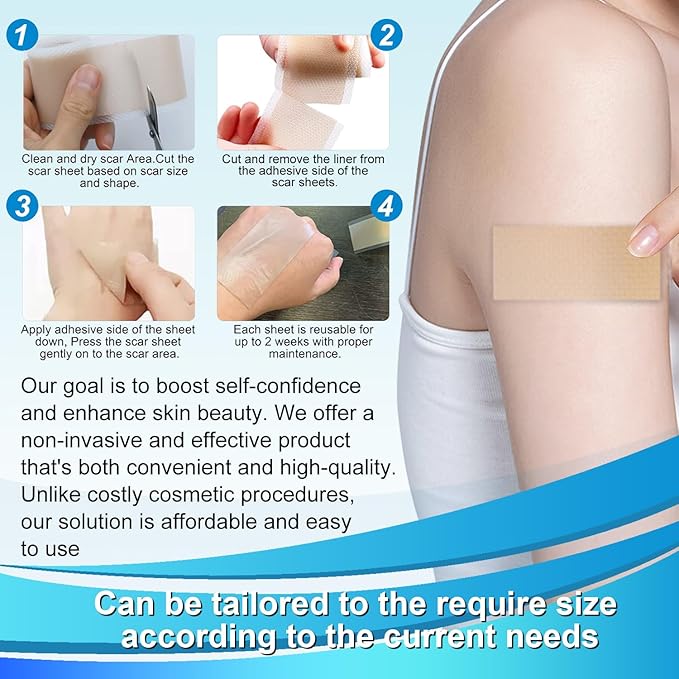 Medical Grade Silicone Scar Tape (1.6" x 157" - 4M) Professional