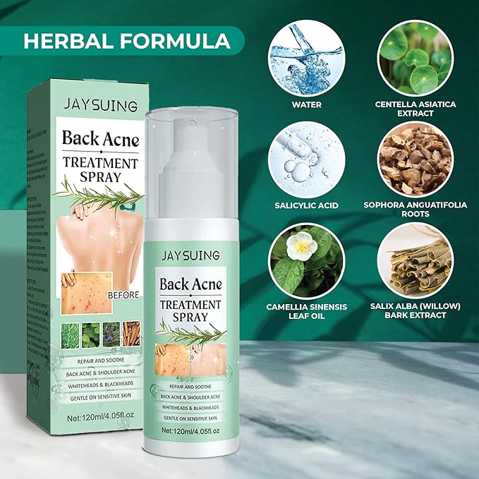 3 Pack Back Acne Treatment, Back 2% Salicylic