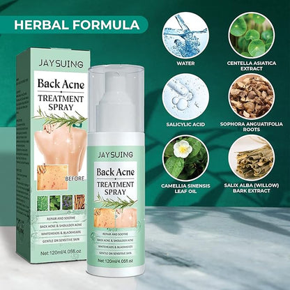 3 Pack Back Acne Treatment, Back 2% Salicylic