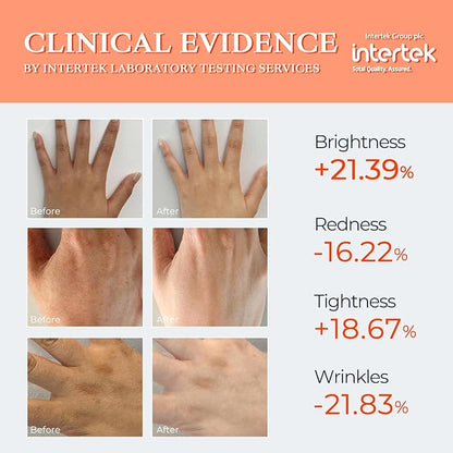 LED Light Therapy Total Hand Care 630nm and 830nm Dual