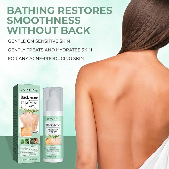3 Pack Back Acne Treatment, Back 2% Salicylic