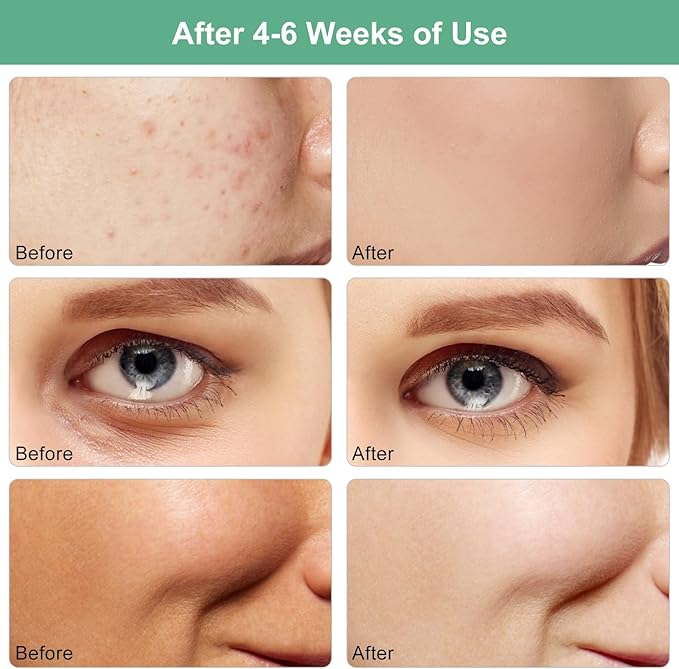 Red Light Therapy for Face 5 Colors 850nm Led