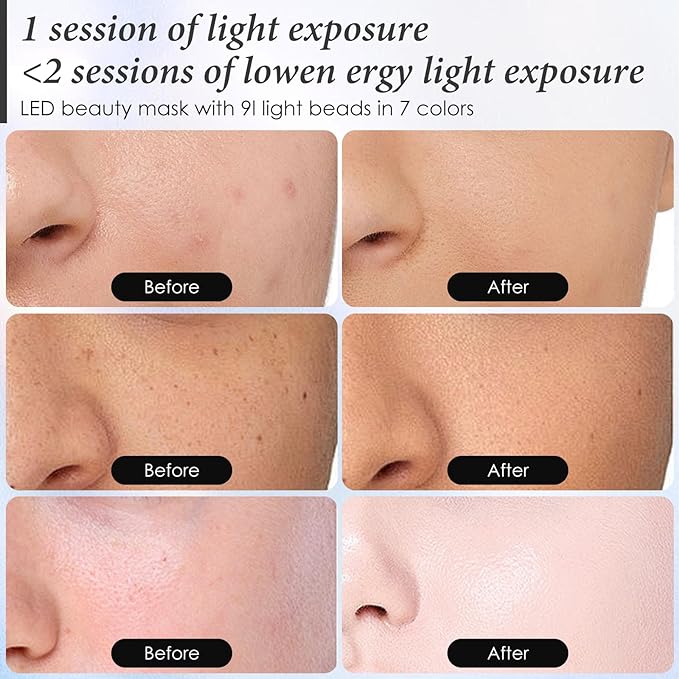 Red Light Therapy Mask for Face, 7 Colors