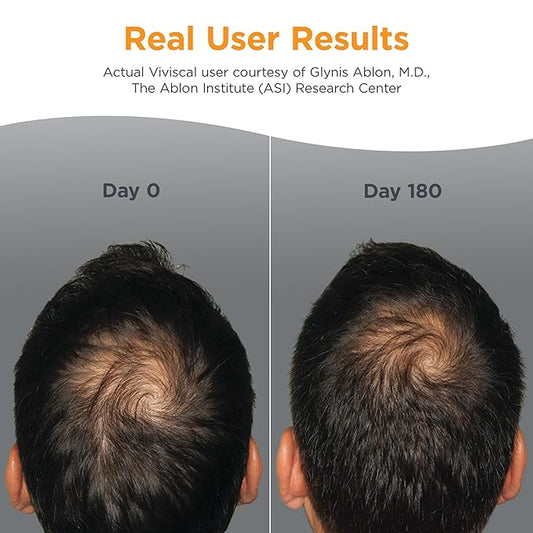 Viviscal Men's Hair Growth Supplements for Thicker, Fuller Hair Clinically Proven with Proprietary Collagen Complex, 60 Tablets - 1 Month Supply