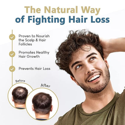 HAIRMETTO® Topical Saw Palmetto and Pumpkin Seed Oil Extract for Hair Loss, Strengthens Hair Roots, Soothes Dry Scalp, with Rosemary, Castor Oil, and Lavender Scent, 4oz Bottle