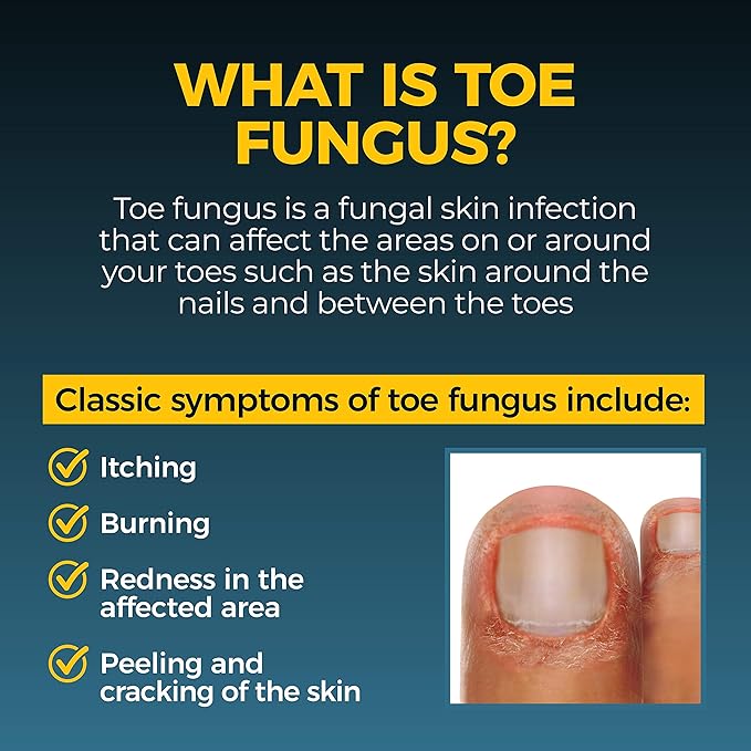 Fungi Nail Anti-Fungal Ointment, Kills Fungus 0.7 Fl