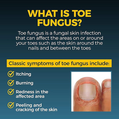 Fungi Nail Anti-Fungal Ointment, Kills Fungus 0.7 Fl