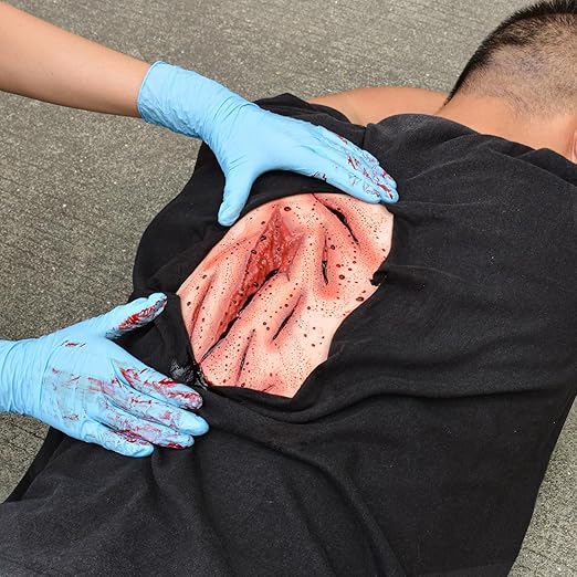 Large Laceration Wounds with Bleeding Function,